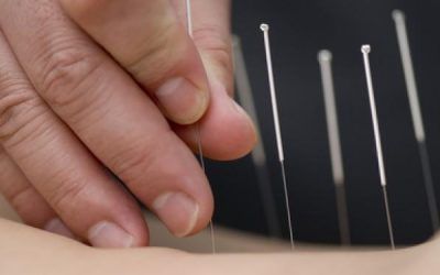 Usos de la acupuntura
